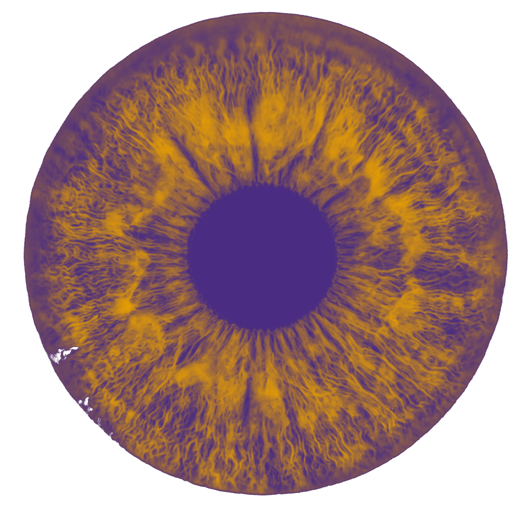 Iris filtre cosmique